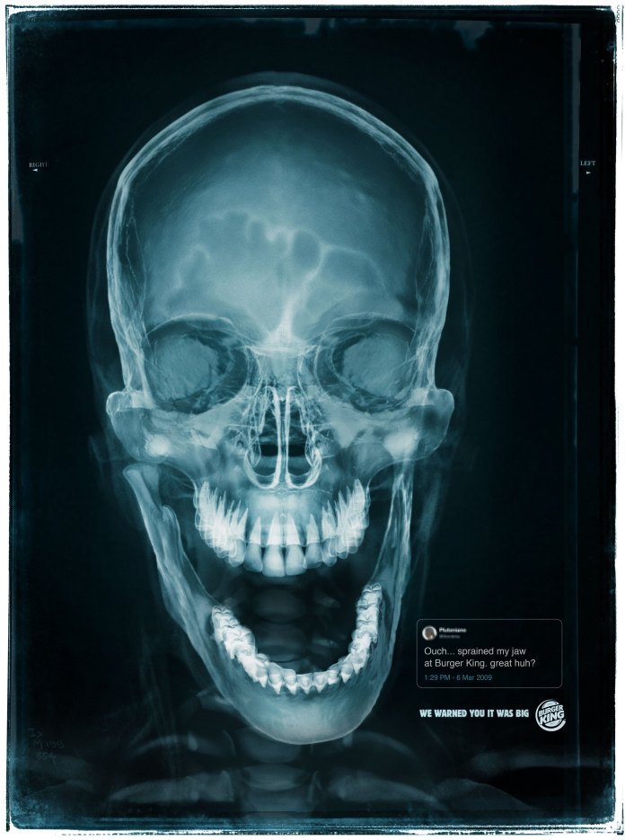 Burger King Created Adverts From X-Rays of Customers